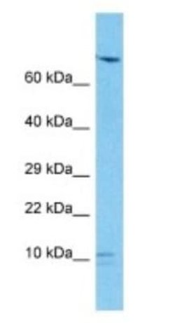 SND1-IT1 Rabbit anti-Human, Polyclonal, Novus Biologicals 100 &mu;g | Buy Online | Novus Biologicals | Fisher Scientific